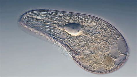 Single-celled Organism Dies | Technology Networks