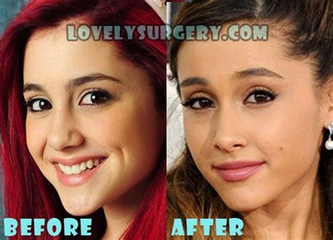 Jabeth Wilson Judge Where Ariana Grande Before Plastic Surgery Saturate