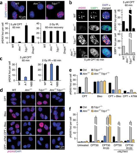 Atm Is Essential For Dna Damage Signaling After Cpt Treatment A