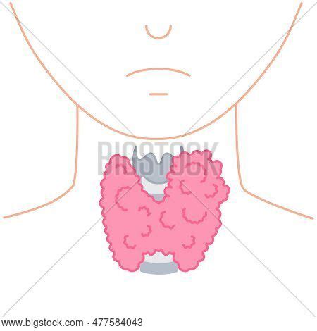 Enlarged Thyroid Vector Photo Free Trial Bigstock