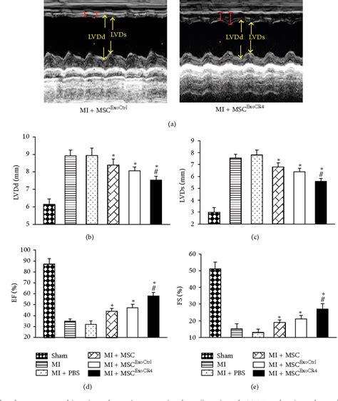 Figure From Exosomes Secreted From Cxcr Overexpressing Mesenchymal