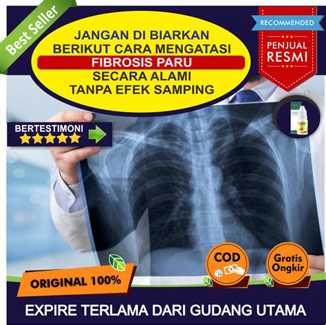 Obat Anti Fibrosis Paru Kanan Obat Alami Untuk Fibrosis Paru Obat