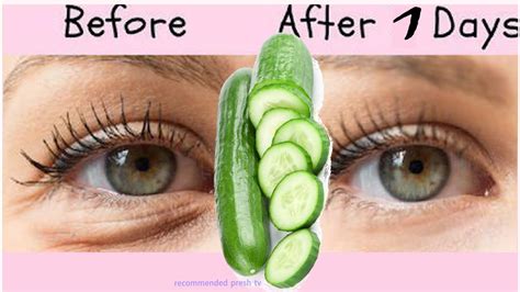 Japanese Women Beauty Secrets To Remove Bags Under Eyes Instantly In 1