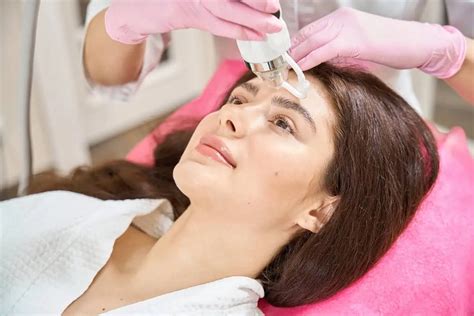 RF Microneedling The Key To Unlocking Flawless Skin