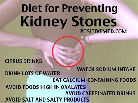 Diet for Preventing Kidney Stones