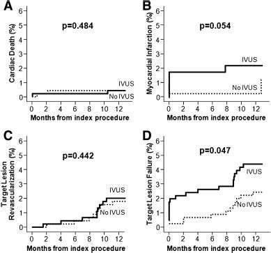 Impact Of Intravascular Ultrasound Guidance In Routine Percutaneous