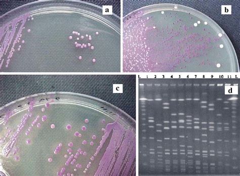 A Appearance Of Mrsa Colonies On Chromagar Mrsa After H Of