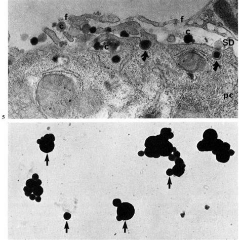 Pinocytosis Of Chylomicrons By Parenchymal Cells Arrows X 299000 Download Scientific Diagram