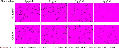 Figure From Gemcitabine And Doxorubicin Combination Enhance The