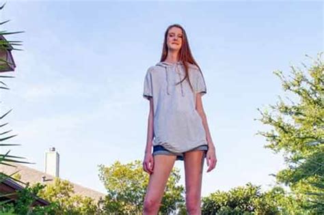 16 Year Old Girl Breaks Guinness World Record With Longest Legs Weirdnews Dunya News