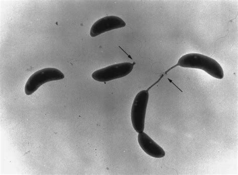 The Holdfast Is Visible After The Initiation Of Stalk Synthesis In This