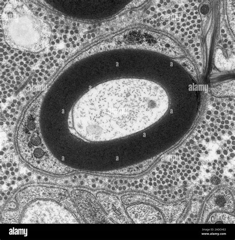 Myelinated Nerve Transmission Electron Micrograph Tem Of Myelinated