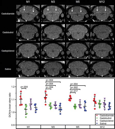 Long Term Gadolinium Retention In The Healthy Rat Brain Comparison