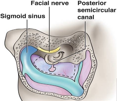 Intracranial Anatomical Triangles A Comprehensive Illustrated Review Pmc