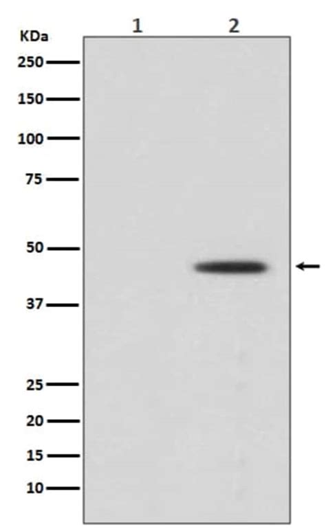 Mek1 P Ser298 Antibody Sr1774 Novus Biologicals 100 μg