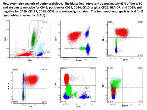 B cell ALL flow cytometry