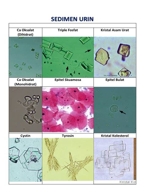 Gambar Sedimen Urin Pdf