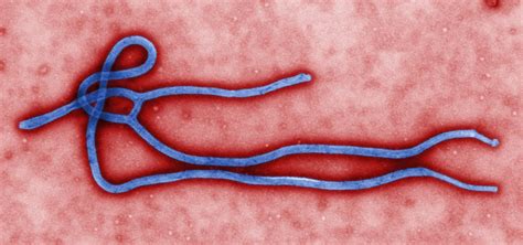 Ebola Hemorrhagic Fever CDC