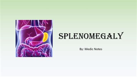 Splenomegaly Causes Pathophysiology Differential Diagnoses Youtube