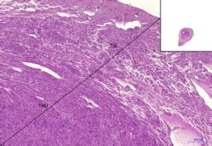 Uterine tube (isthmus) - HE - WikiLectures