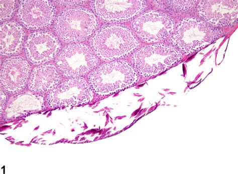 Testis Mineralization Nonneoplastic Lesion Atlas