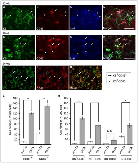 The Spinal Cord Sections Of Sod1g93a Mice At 12 18 And 24 Weeks Were Download Scientific