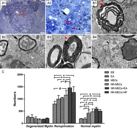 Diverse Morphological Forms Of Myelin Sheath And Numerical Comparison