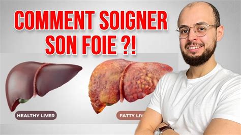 Comment Soigner Le Foie Gras St Atose H Patique Youtube