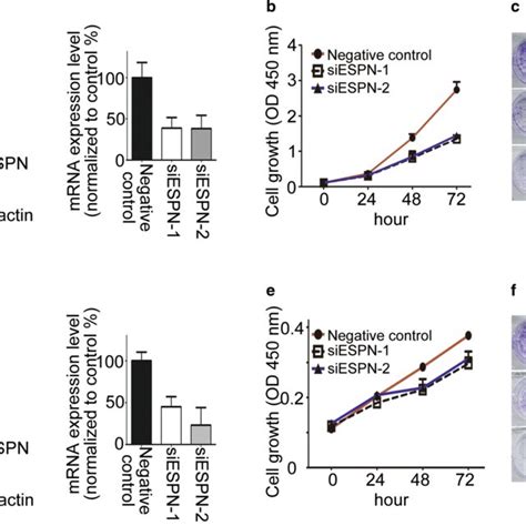 Knockdown Of Espn Inhibited Escc Cells Growth In Vitro A C The