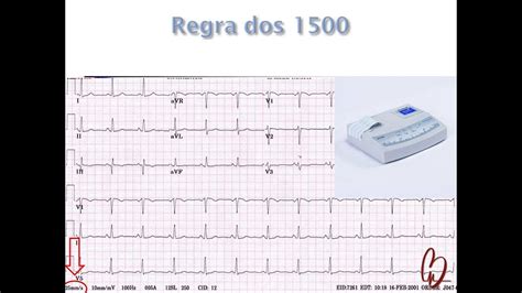 Como Calcular A Frequência Cardíaca No Ecg Parte 1 Youtube