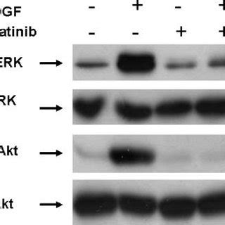 Imatinib Mesylate Inhibits Collagen Synthesis In Human Breast Stromal