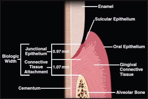 What is the Biologic width around a Tooth? - Tooronga Family Dentistry ...