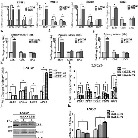 Basal Expression Of Sdc And Emt Markers In Epithelial And Prostate