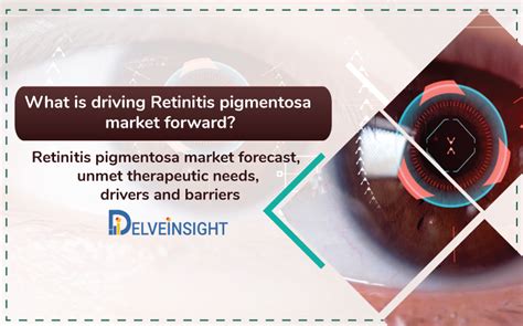 Retinitis Pigmentosa RP Market RP Market Forecast Pipeline Analysis