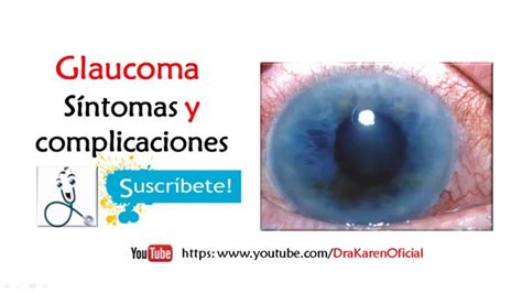 Glaucoma Síntomas Y Complicaciones Del Glaucoma Youtube