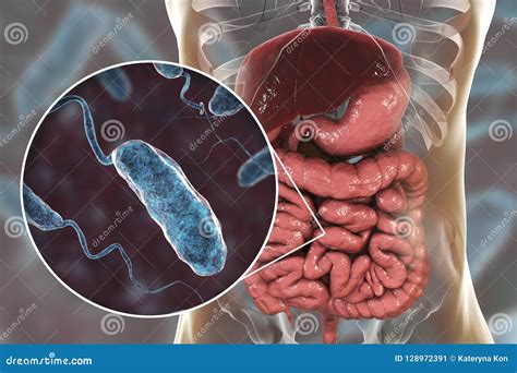 Vibrio Cholerae Bacteria In Small Intestine Stock Illustration