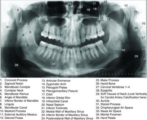 Panoramic Radiograph Anatomy - Anatomical Charts & Posters