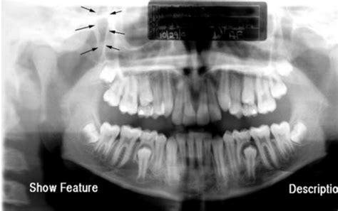 D2 Radiology Sectional I Radiographic Anatomy Of CBCT Intraoral And