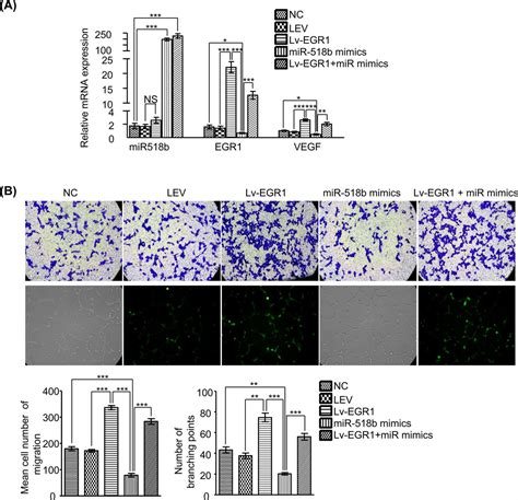 Increased MiRNA 518b Inhibits Trophoblast Migration And Angiogenesis By