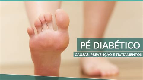 P Diab Tico Sintomas E Tratamentos Para Prevenir Complica Es Youtube