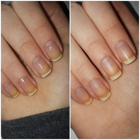 Nail Growth Update This Is 2 Weeks In The Difference I Forgot To Take