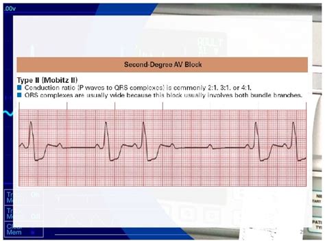 Pediatric Electrocardiogram Interpretation Majid Shojaee Md Associate