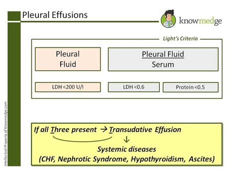 Light’s Criteria Will Guide You To Correctly Identifying Pleural Effusions As Either Exudative