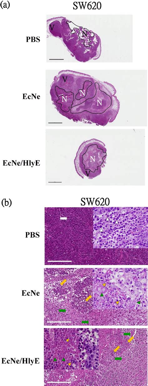 H E Staining Of Tumor Tissues And Organs H E Staining Was Applied To