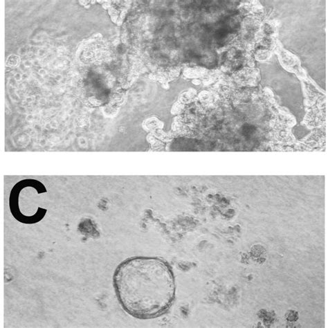 Morphology Observed For MCF 10A MCF 10AT And MCF 10CA1a Cells Grown