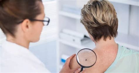 Dermatologist Appointment Guide What To Expect During Your Visit