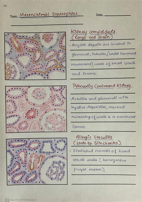 SOLUTION: Pathological anatomy hand drawn diagrams of micro slides easy ...