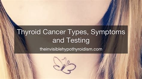 10 Signs Of Thyroid Cancer