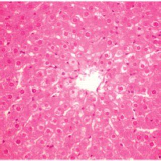 Ccl Merv Mg Kg Treated Group Rat Liver Section Showing Typical