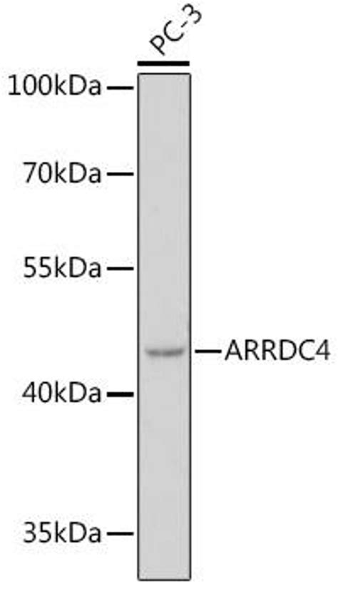 Anti Arrdc4 抗体 Cab18522 Assay Genie